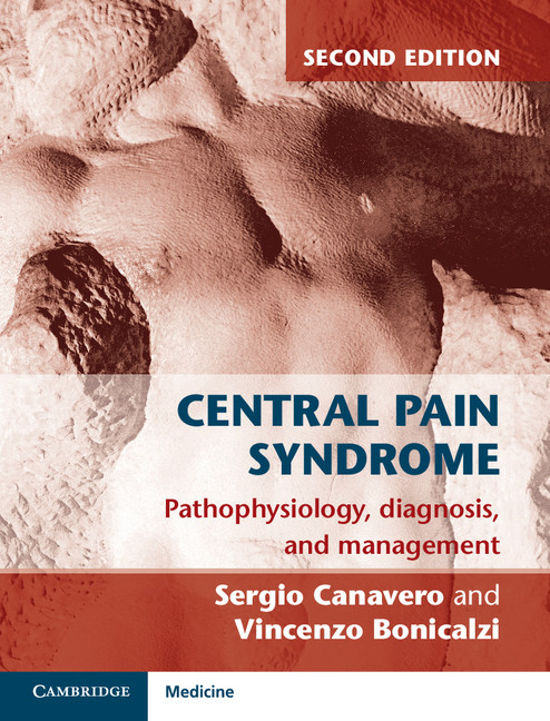 Pain syndrome. Central Pain Syndrome.