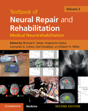 4 Upper-Extremity Prostheses, The Promise of Assistive Technology to  Enhance Activity and Work Participation