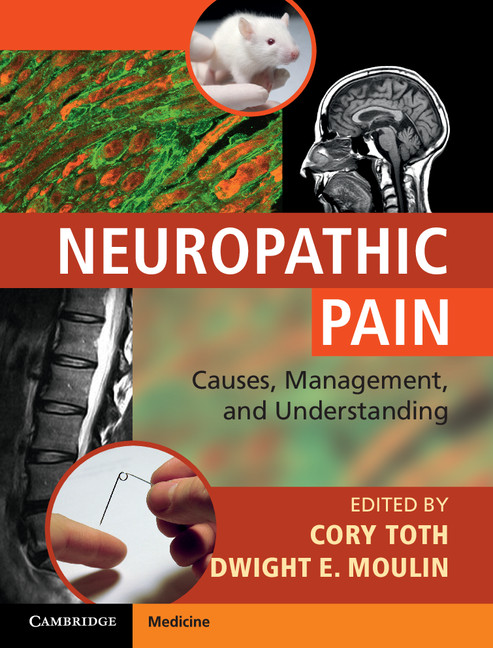 An overview of animal models for neuropathic pain (Chapter 4 ...