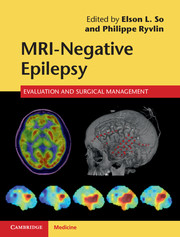 MRI-Negative Epilepsy