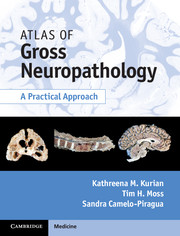 Atlas of Gross Neuropathology