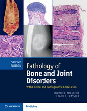 Pathology of Bone and Joint Disorders
