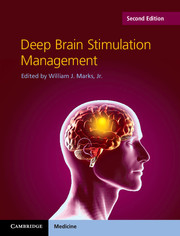 Deep Brain Stimulation Management
