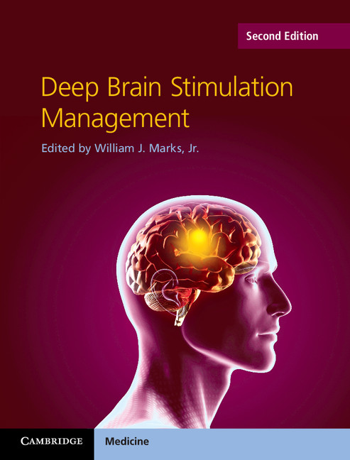 Deep brain. Nao Brain stimulation таблетки. ДИИП брайин Стимулейшн. Oxford Handbook of Neurology. Нейрофизиология художественный картинки.