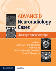 Advanced Neuroradiology Cases