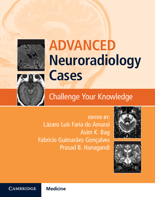 Advanced Neuroradiology Cases