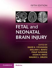 Fetal and Neonatal Brain Injury