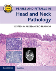 Pearls and Pitfalls in Head and Neck Pathology