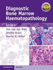Diagnostic Bone Marrow Haematopathology