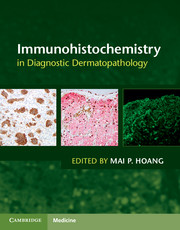 Immunohistochemistry in Diagnostic Dermatopathology
