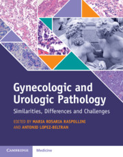Gynecologic and Urologic Pathology