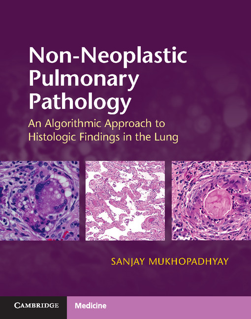 Non-Neoplastic Pulmonary Pathology