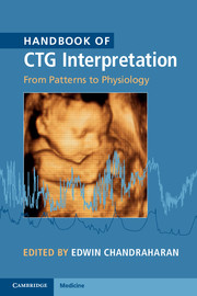 Handbook of CTG Interpretation