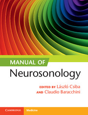 Manual of Neurosonology