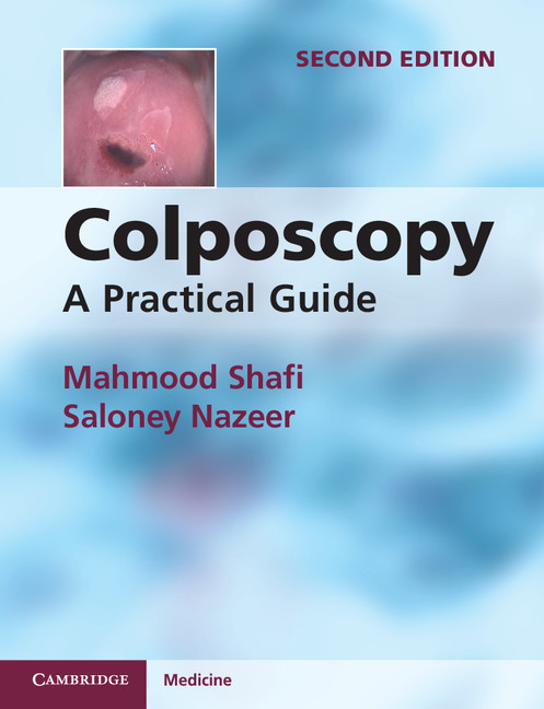 The Normal Cervix And Colposcopic Appearance Chapter 2 Colposcopy