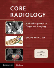 Radiology Pdf Books