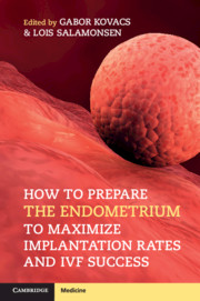 How to Prepare the Endometrium to Maximize Implantation Rates and IVF Success