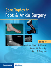 Core Topics in Foot and Ankle Surgery