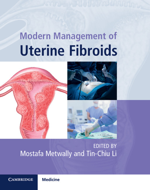 Pathophysiology Of Uterine Fibroids Chapter 1 Modern Management Of Uterine Fibroids