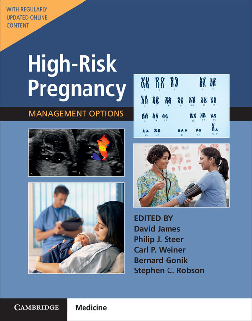 High Risk Pregnancy Management Options 4258