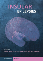 Insular Epilepsies