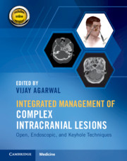 Integrated Management of Complex Intracranial Lesions