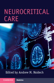 Cambridge Manuals in Neurology