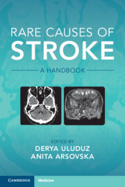 Rare Causes of Stroke