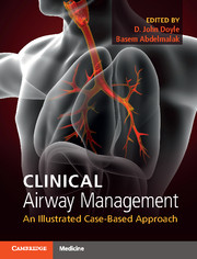Clinical Airway Management