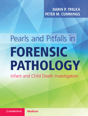 Pearls and Pitfalls in Forensic Pathology
