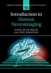 Introduction to Human Neuroimaging | Higher Education from Cambridge