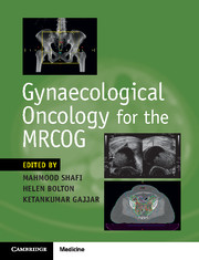 Gynaecological Oncology for the MRCOG (2018) (PDF) Mahmood Shafi
