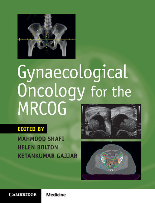 Gynaecological Oncology For The Mrcog