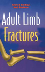 Adult Limb Fractures