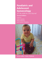 Paediatric and Adolescent Gynaecology for the MRCOG and Beyond