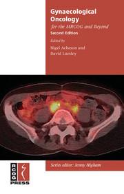 Gynaecological Oncology for the MRCOG and Beyond